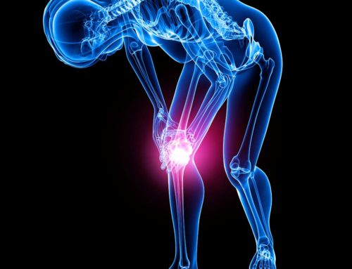 ACL Knee Instability – Can You Fix It Without Surgery?