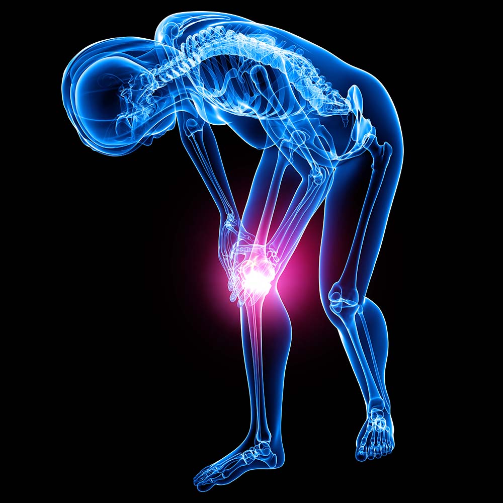 ACL knee and hip replacement care physical therapy rehabilitation in Brooklyn nyc