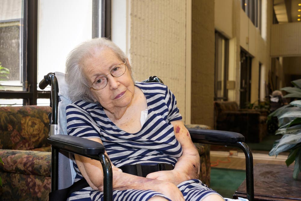 Elderly women recovering/regaining her speech after a stroke