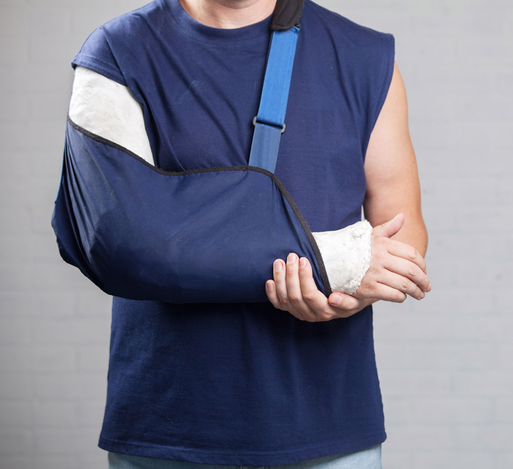 Women with a fracture shoulder on grey background