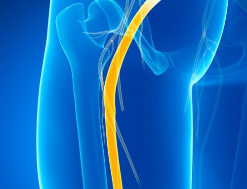 3 Most Common Causes of Sciatic Nerve Pain