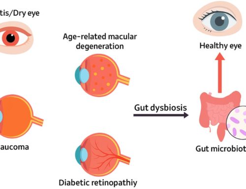 Healthy Gut, Healthy Eyes: Is the Gut-Vision Axis Real